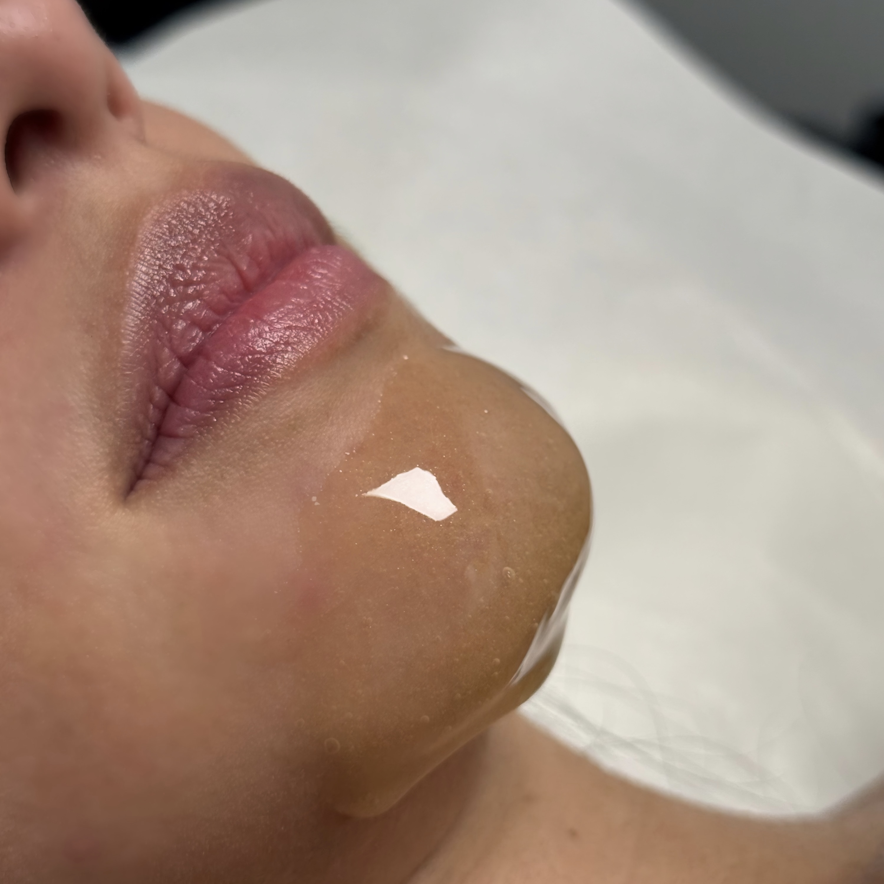 Chin service