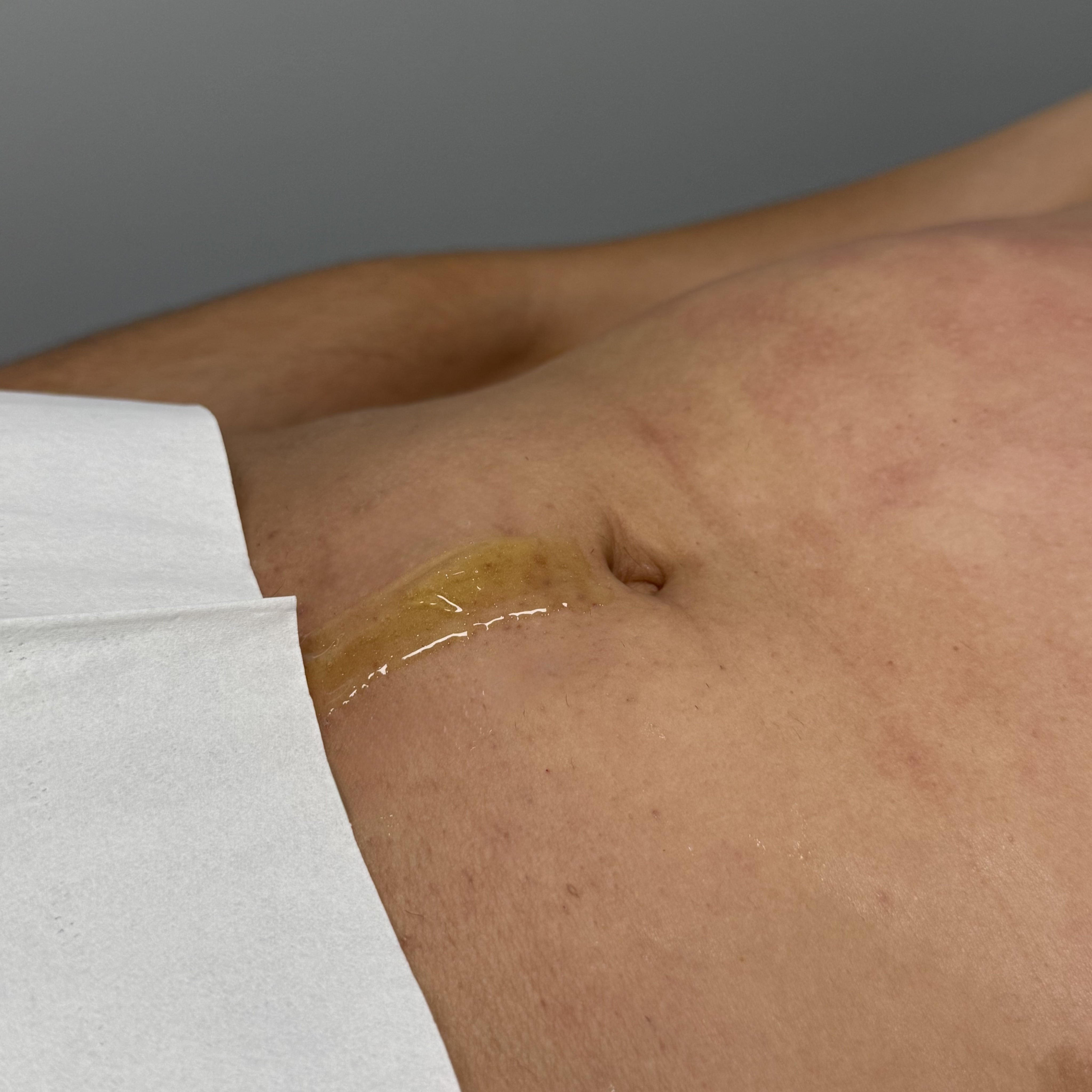 Stomach Trail service